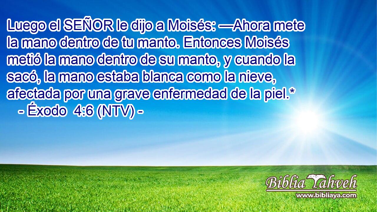 Luego el SEÑOR le dijo a Moisés: —Ahora mete la mano dentro de tu manto. Entonces Moisés metió la mano dentro de su manto, y cuando la sacó, la mano estaba blanca como la nieve, afectada por una grave enfermedad de la piel.*