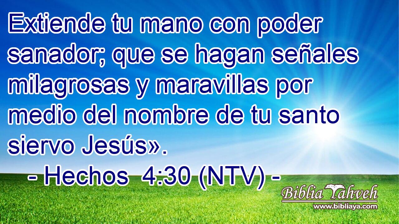 Extiende tu mano con poder sanador; que se hagan señales milagrosas y maravillas por medio del nombre de tu santo siervo Jesús».