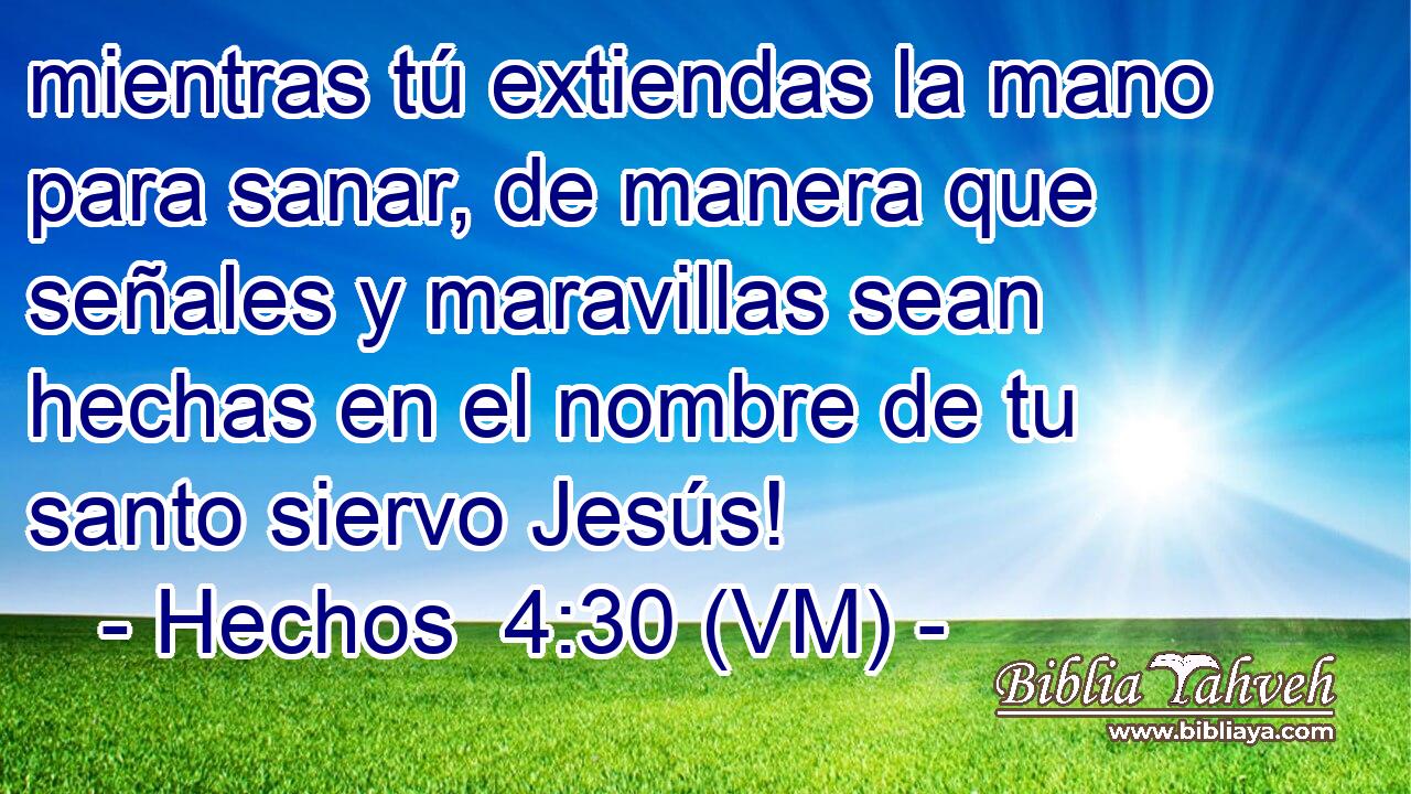  mientras tú extiendas la mano para sanar, de manera que señales y maravillas sean hechas en el nombre de tu santo siervo Jesús! 