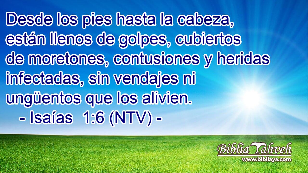 Desde los pies hasta la cabeza, están llenos de golpes, cubiertos de moretones, contusiones y heridas infectadas, sin vendajes ni ungüentos que los alivien.