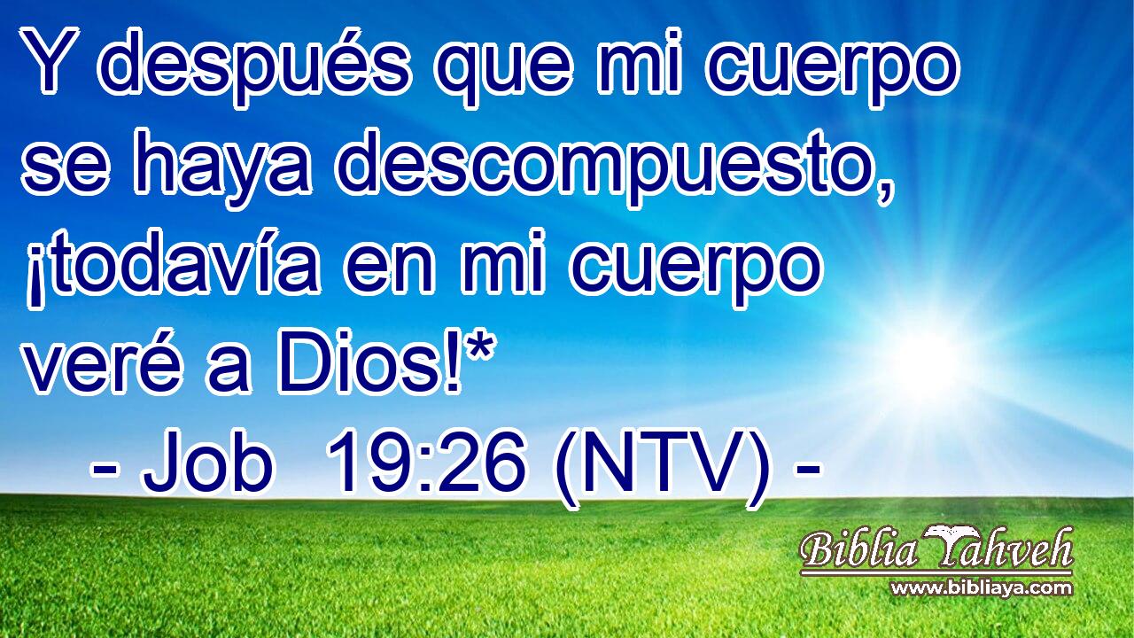Y después que mi cuerpo se haya descompuesto, ¡todavía en mi cuerpo veré a Dios!*