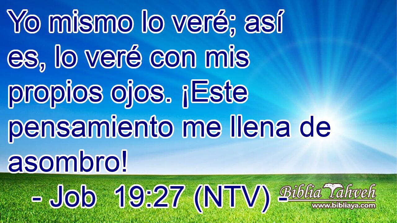 Yo mismo lo veré; así es, lo veré con mis propios ojos. ¡Este pensamiento me llena de asombro!