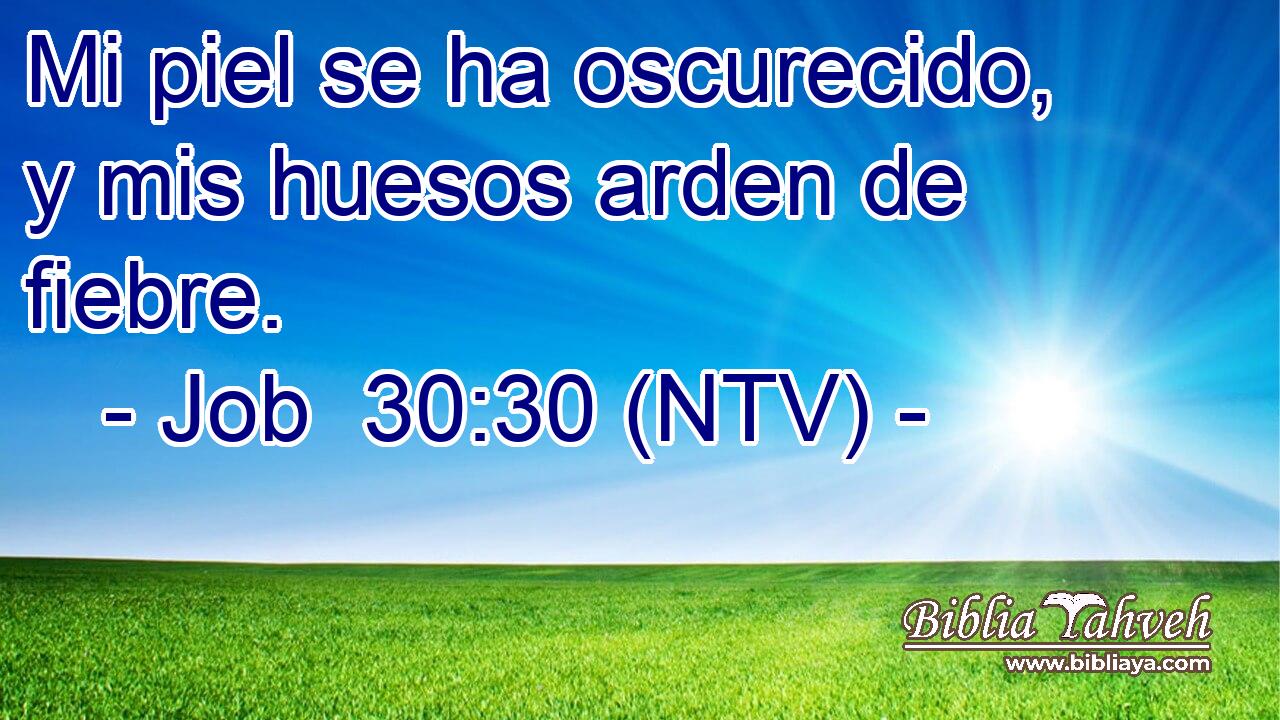 Mi piel se ha oscurecido, y mis huesos arden de fiebre.