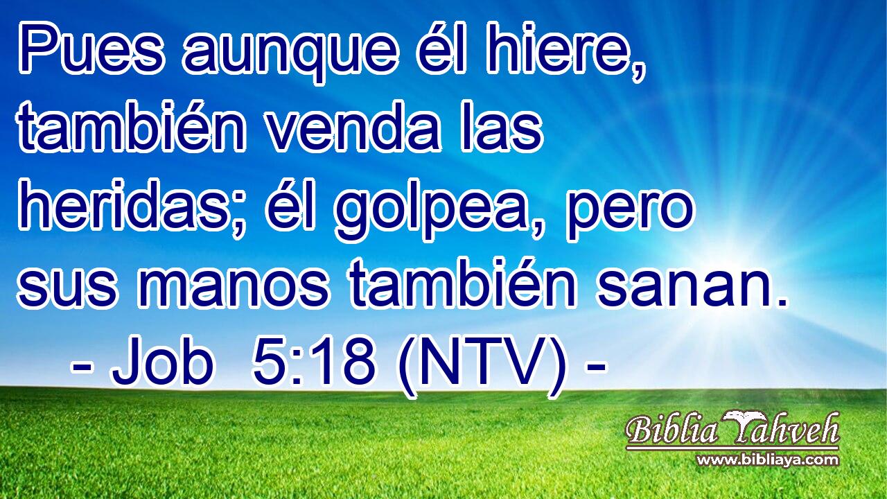 Pues aunque él hiere, también venda las heridas; él golpea, pero sus manos también sanan.