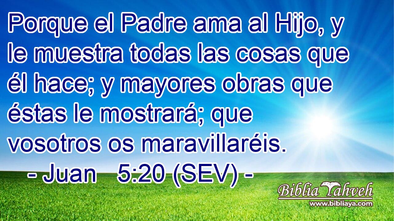 Porque el Padre ama al Hijo, y le muestra todas las cosas que él hace; y mayores obras que éstas le mostrará; que vosotros os maravillaréis.