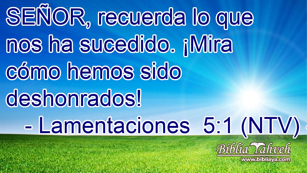 SEÑOR, recuerda lo que nos ha sucedido. ¡Mira cómo hemos sido deshonrados!