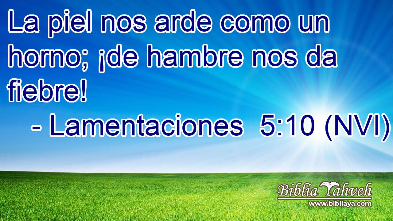  La piel nos arde como un horno; ¡de hambre nos da fiebre! 
